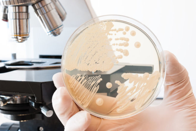 Gljivica-Candida-je-uzrocnik-vaginalnih-infekcija