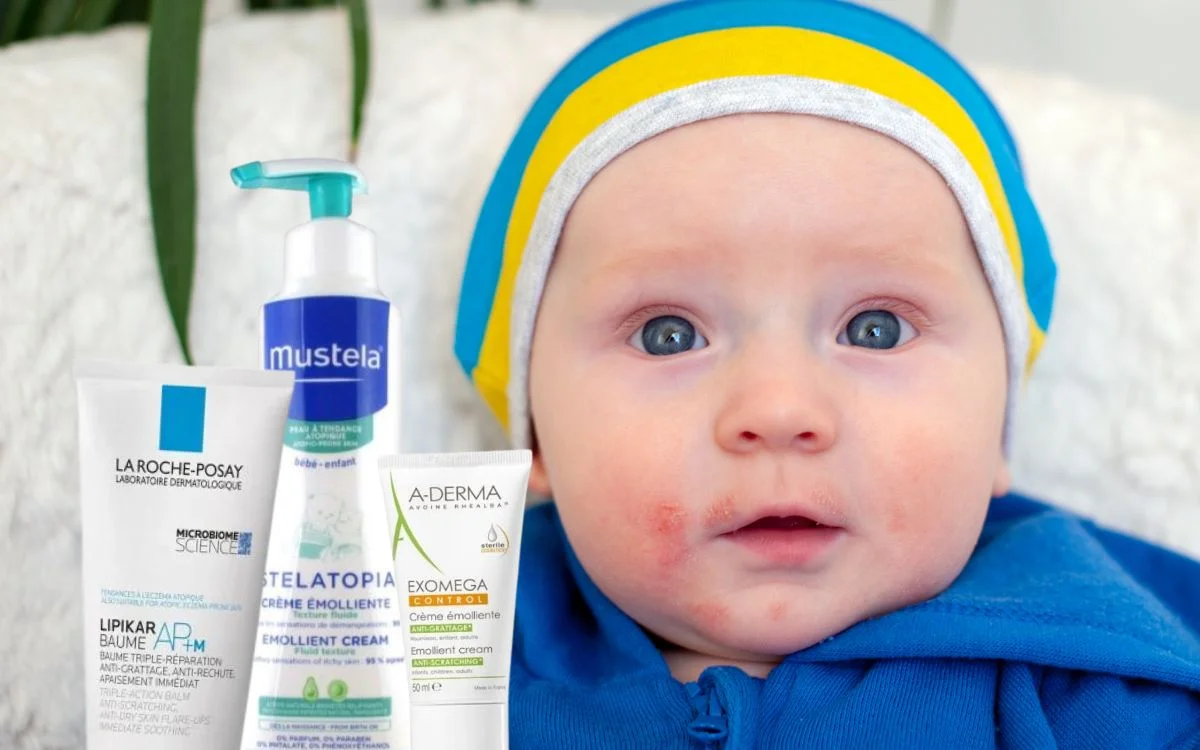 Atopijski dermatitis kod beba